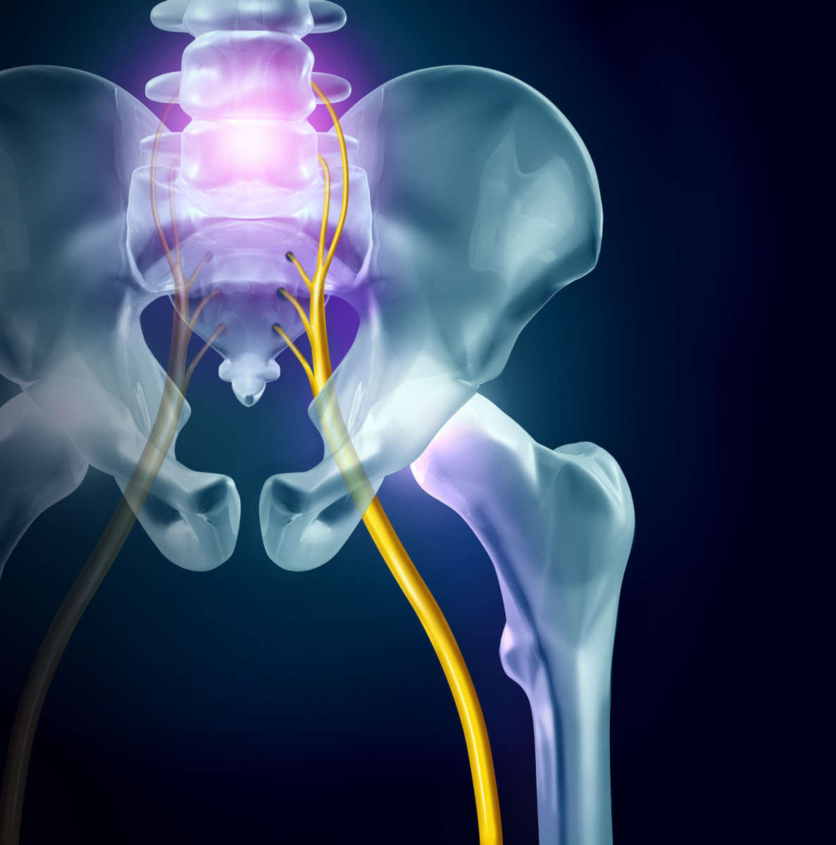 For Sciatica Relief, Seek The Chiropractor In Mission Viejo
