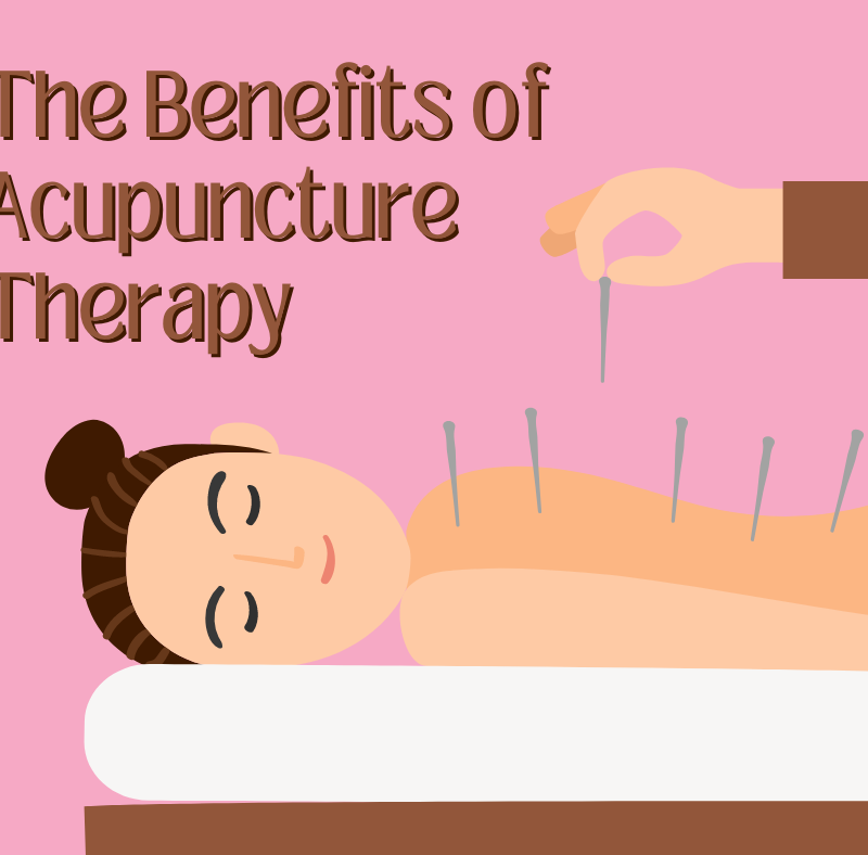 The Benefits of Acupuncture Therapy
