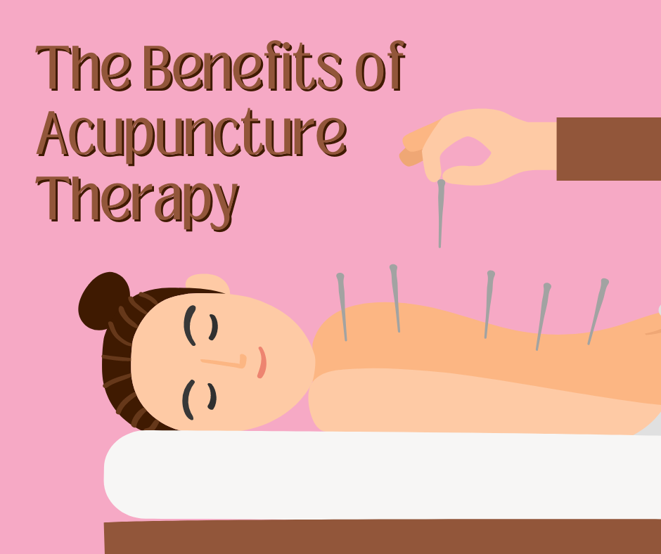 Acupuncture therapy is great for back pain.